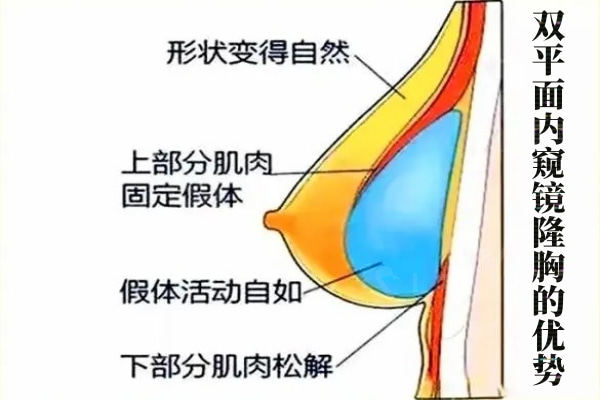 夏建军医生的隆胸价格高吗？价格表显示夏建军曼托隆胸2万+傲诺拉隆胸6.8万+宝俪隆胸7.5万+