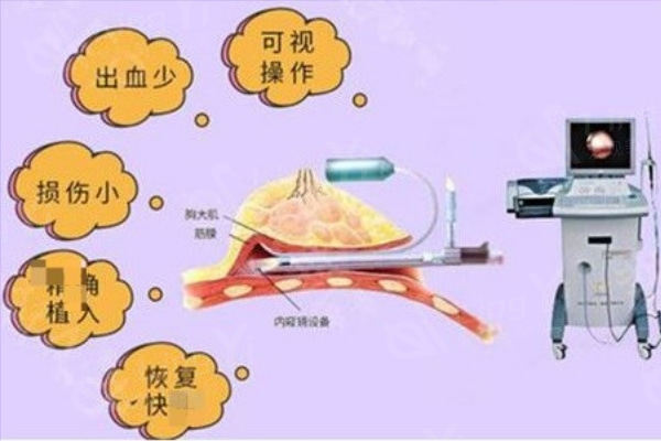 北京孙泽芳脂肪隆胸在线预约通道:线上/电话/网络/现场均可挂号预约孙泽芳脂肪移植医生