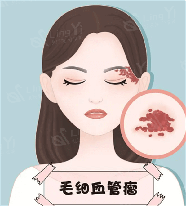 石家庄丰眉弓排名好的整形医院名单 这些排名里大家都觉得石家庄天宏医疗美容医院/创美很不错 