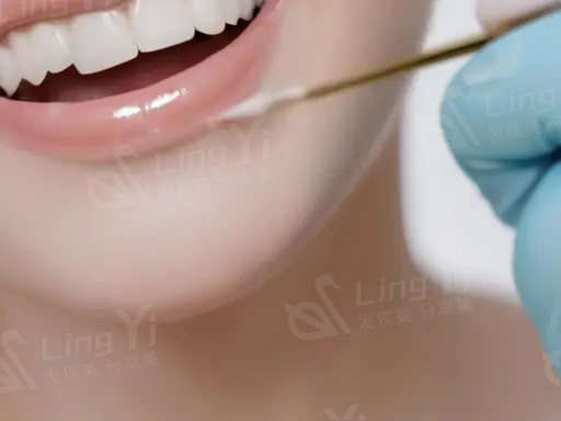 做数字化3D种植导板后，可以吃冰淇淋吗？了解你的饮食选择！