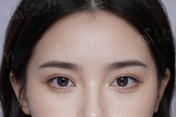 指甲易断裂分层？多吃鸡蛋补充生物素强韧甲面