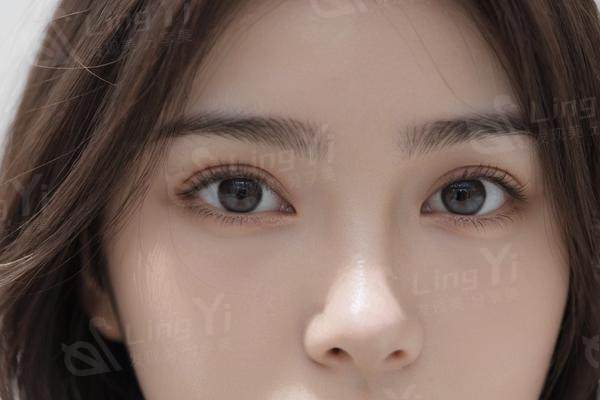 做奥美定异物取出过程，如何靠谱快速实现美丽蜕变？