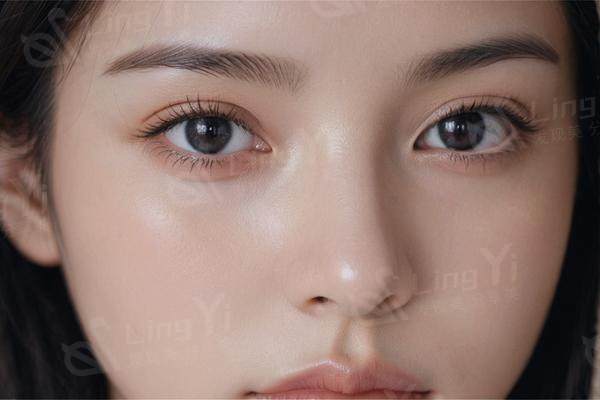 塌鼻子想变挺？这些隆鼻方式优缺点一次说清