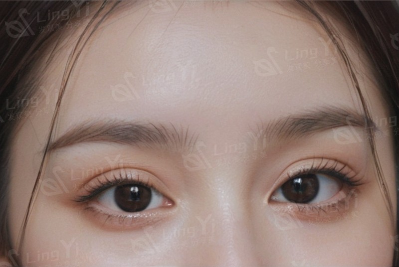 医美前后注意事项大全，这样做恢复快效果更好