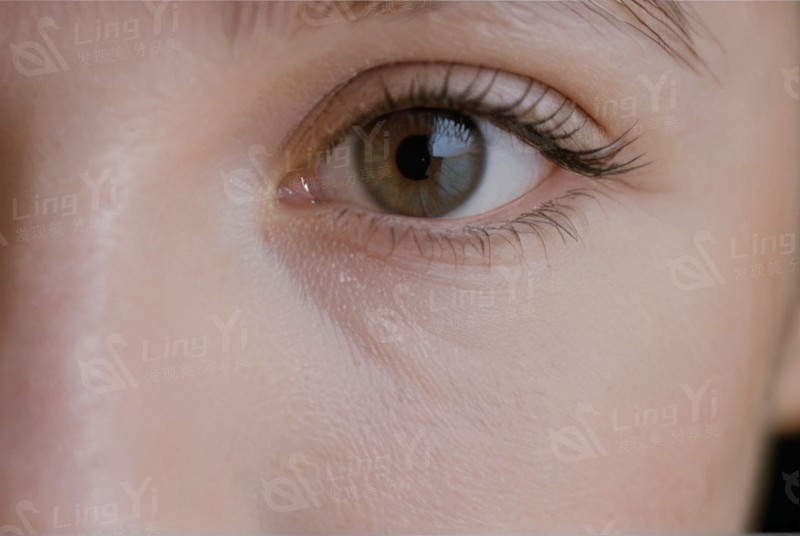 揭秘哈尔滨云海眼科医院收费高吗?验光配镜及激光手术价格表参考