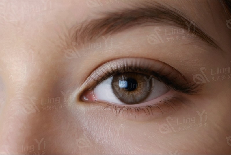 哈尔滨龙润眼科价格表大揭秘，看看这里的眼科项目收费贵不贵