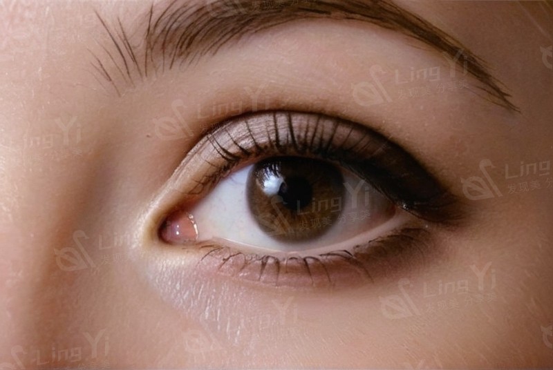 大连华厦眼科怎么样？正规靠谱价格不坑人，口碑真实技术到位