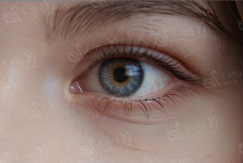 大连华厦眼科怎么样?正规靠谱价格不坑人,口碑真实技术到位 大连华厦眼科怎么样?正规靠谱价格不坑人,口碑真实技术到位