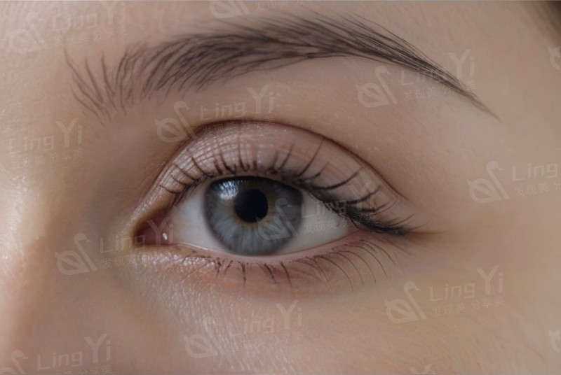 激光治疗近视后会反弹吗？如何保持好视力