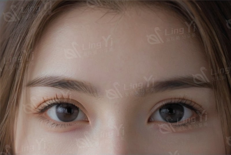 皮肤粗糙暗沉没光泽？海菲秀超声刀焕肤技巧与保养好处快知晓