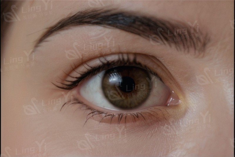 武汉观视界眼科正规吗？口碑评价及医院资质告诉你答案