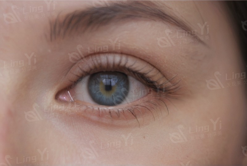 武汉爱尔眼科汉口医院怎么样？医生技术 / 手术设备展现诊疗实力