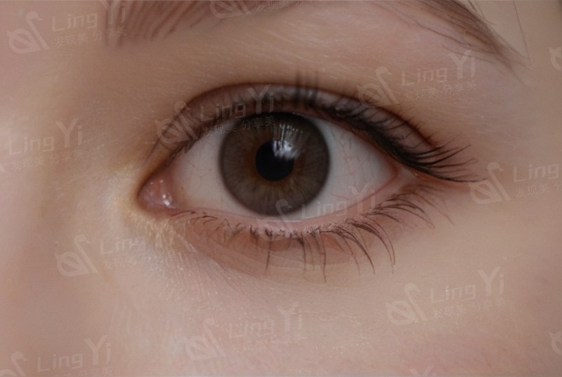 眼药水能乱滴吗？眼药水使用的避雷指南！