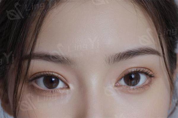塌鼻梁想变挺？别乱做医美！这几个自然改善小妙招亲测有效